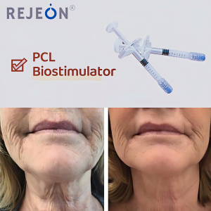 REJEON PCL Filler Injection Anti-wrinkle lifting and firming