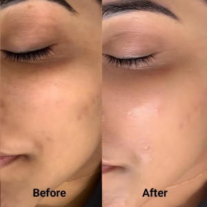 REJEON Remove Freckles Serum Removes Freckles Shrinks Pores Whiten